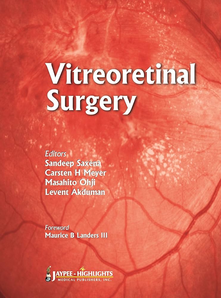 健康・医学 Vitreoretinal Surgery Vitreoretinal Surgery | SpringerLink